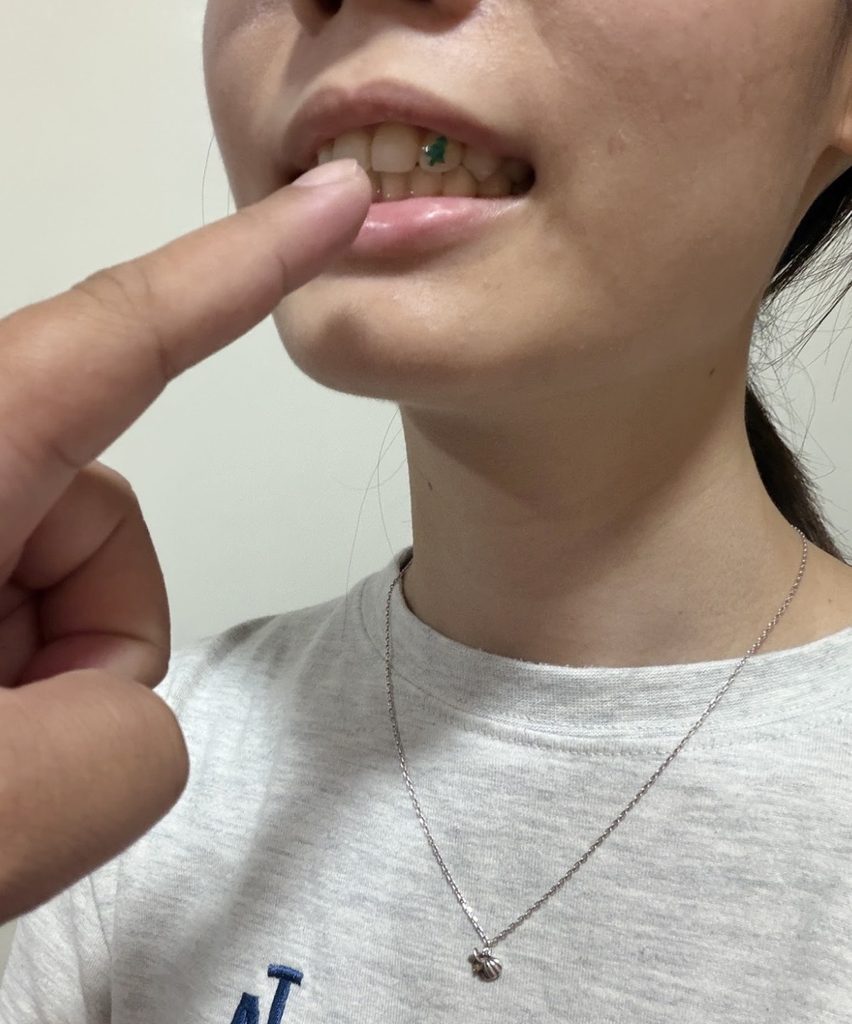 女網友的爸爸誤認為是菜渣。圖/讀者提供