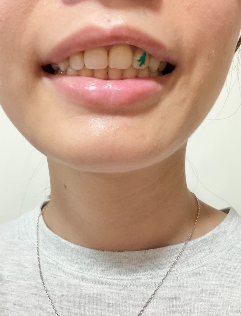 女網友買高露潔聖誕閃耀限量版牙膏,她刷牙時把閃片貼在牙齒上,父親與店員看了都很有反應。圖/讀者提供